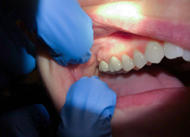 Best Walk-In Emergency Dental Services in Elwood, UT